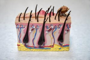 花粉症による目元のかゆみと皮膚炎の対策は？